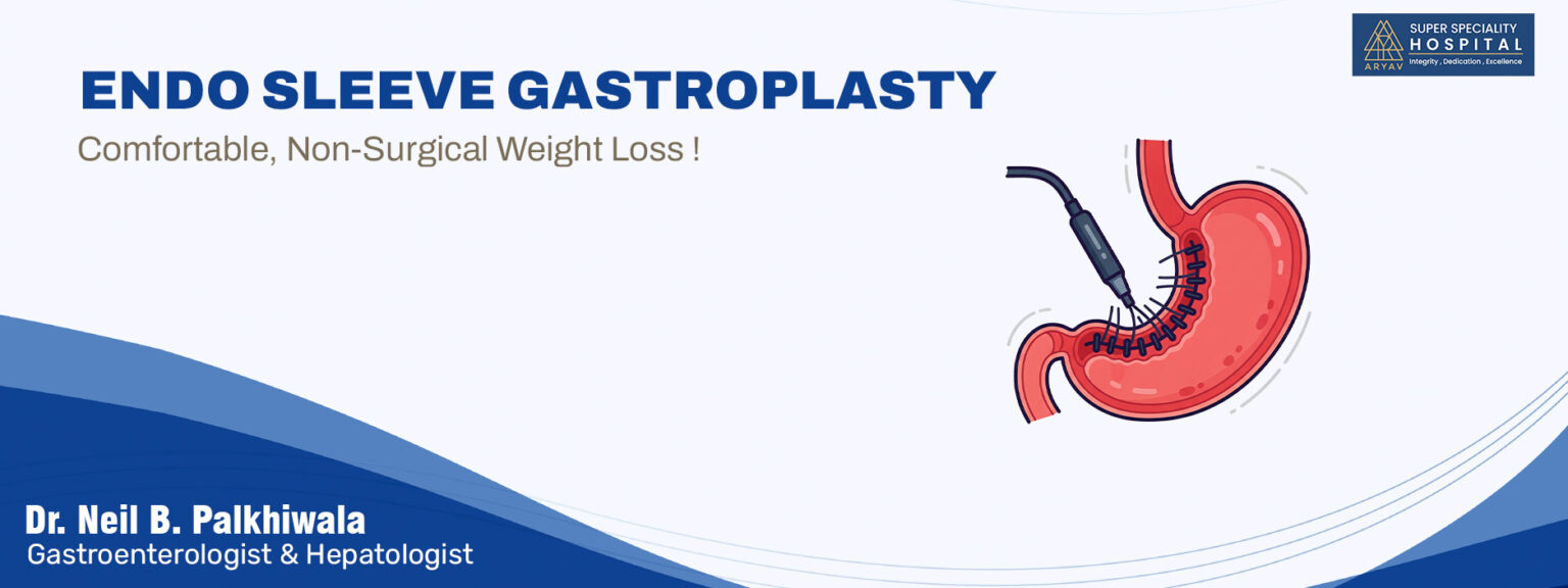 Endoscopic Sleeve Gastroplasty